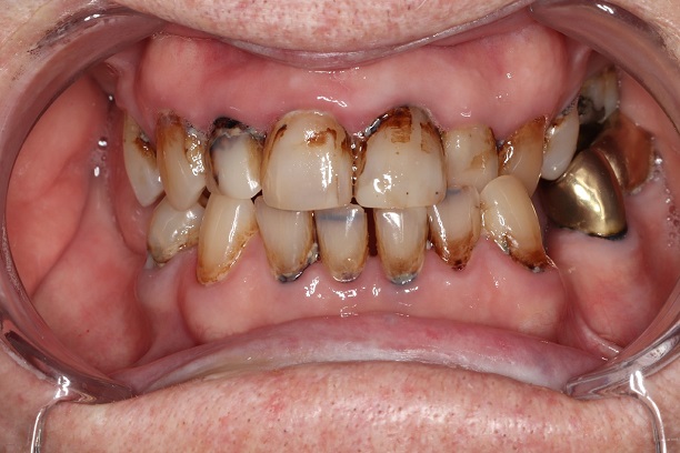Before - Case 5