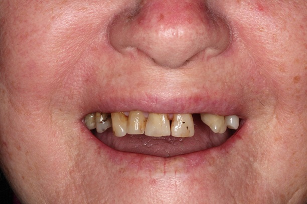 Before - Case 1