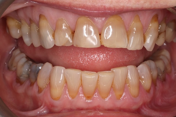 Before - Case 5