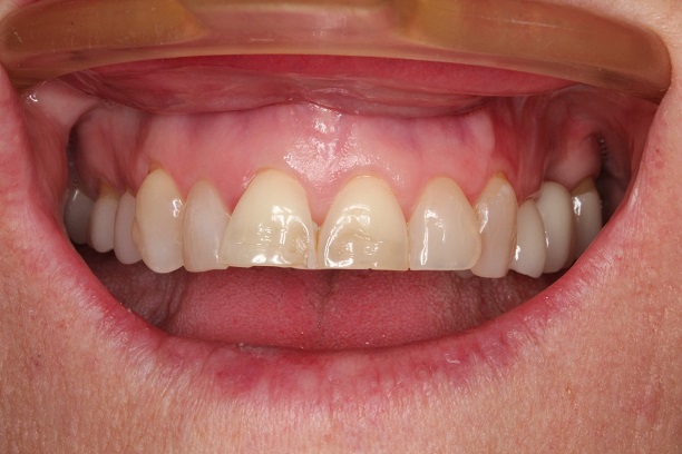 Before - Case 2