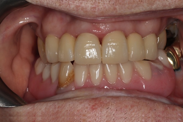 transformation-4-2 transformation-4-2